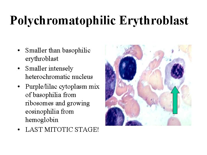 Polychromatophilic Erythroblast • Smaller than basophilic erythroblast • Smaller intensely heterochromatic nucleus • Purple/lilac Polychromatophilic Erythroblast • Smaller than basophilic erythroblast • Smaller intensely heterochromatic nucleus • Purple/lilac