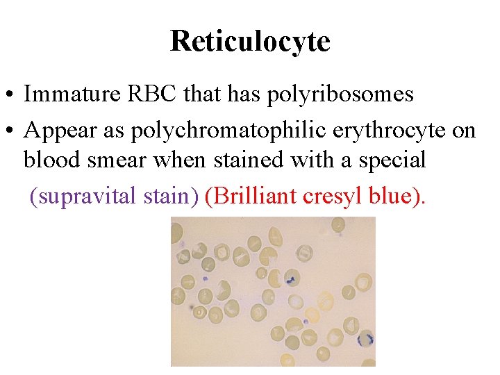 Reticulocyte • Immature RBC that has polyribosomes • Appear as polychromatophilic erythrocyte on blood Reticulocyte • Immature RBC that has polyribosomes • Appear as polychromatophilic erythrocyte on blood