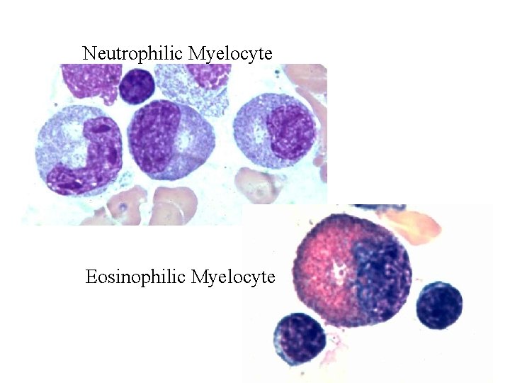 Neutrophilic Myelocyte Eosinophilic Myelocyte  Neutrophilic Myelocyte Eosinophilic Myelocyte