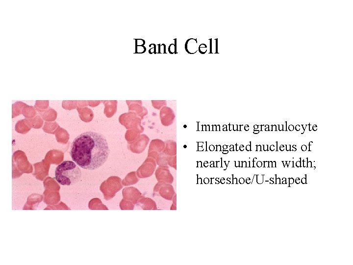 Band Cell • Immature granulocyte • Elongated nucleus of nearly uniform width; horseshoe/U-shaped  Band Cell • Immature granulocyte • Elongated nucleus of nearly uniform width; horseshoe/U-shaped
