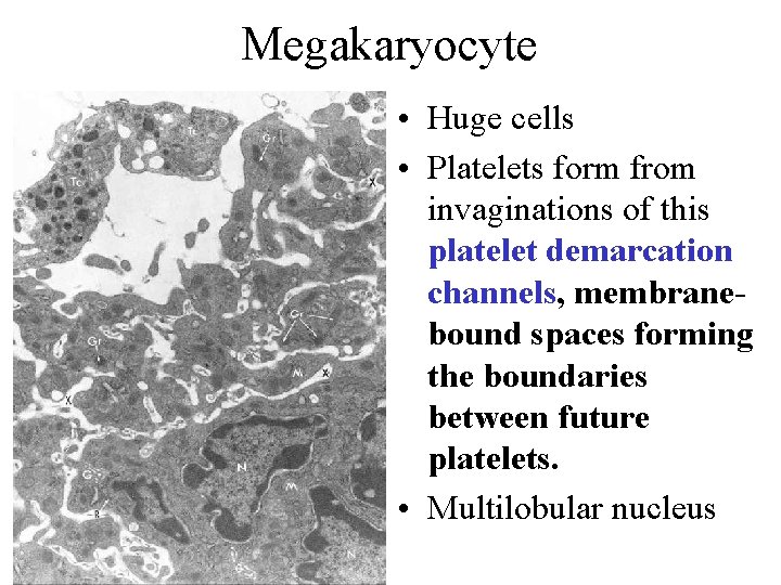 Megakaryocyte • Huge cells • Platelets form from invaginations of this platelet demarcation channels, Megakaryocyte • Huge cells • Platelets form from invaginations of this platelet demarcation channels,