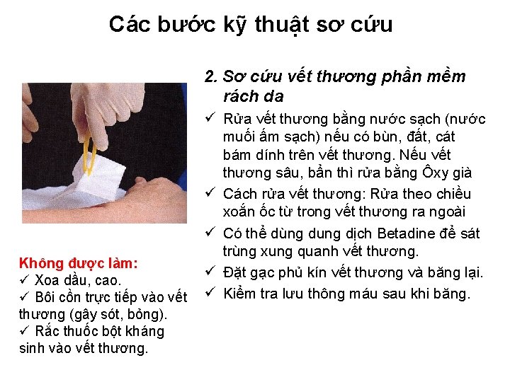 Các bước kỹ thuật sơ cứu 2. Sơ cứu vết thương phần mềm rách Các bước kỹ thuật sơ cứu 2. Sơ cứu vết thương phần mềm rách