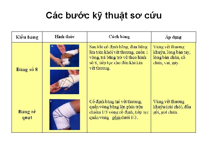 Các bước kỹ thuật sơ cứu Các bước kỹ thuật sơ cứu