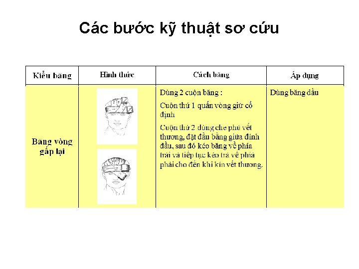 Các bước kỹ thuật sơ cứu Các bước kỹ thuật sơ cứu