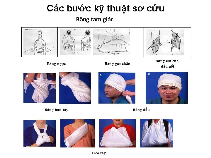 Các bước kỹ thuật sơ cứu Băng tam giác Các bước kỹ thuật sơ cứu Băng tam giác
