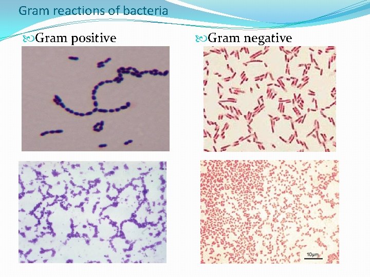 Gram reactions of bacteria Gram positive Gram negative 