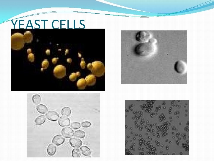 YEAST CELLS 