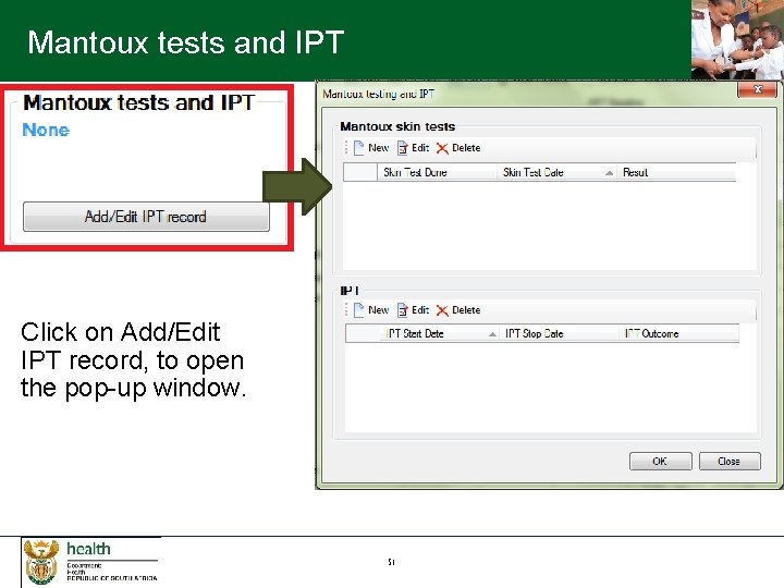 Mantoux tests and IPT Click on Add/Edit IPT record, to open the pop-up window.