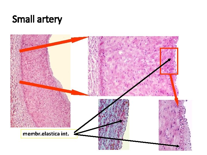Small artery membr. elastica int. 