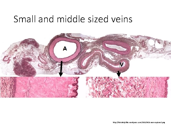 Small and middle sized veins http: //histohelp. files. wordpress. com/2011/09/screen-capture 2. png 