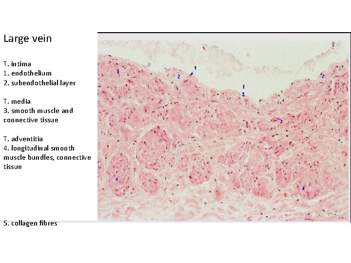 Large vein T. intima 1. endothelium 2. subendothelial layer T. media 3. smooth muscle