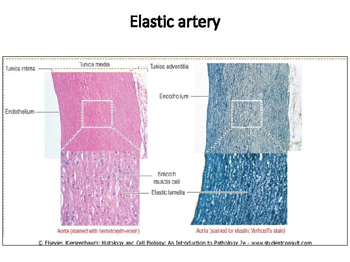 Elastic artery 