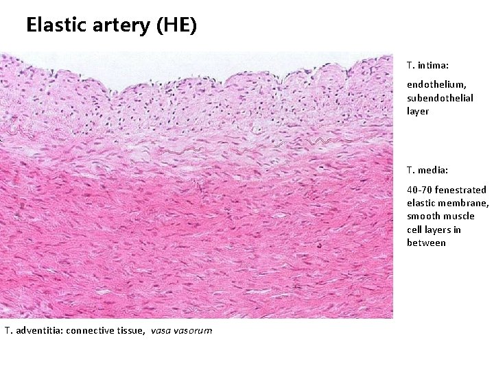 Elastic artery (HE) T. intima: endothelium, subendothelial layer T. media: 40 -70 fenestrated elastic
