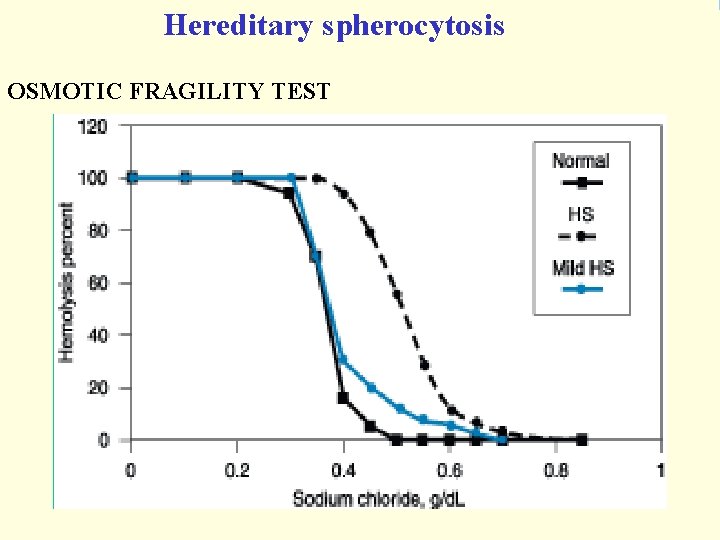 Hereditary spherocytosis OSMOTIC FRAGILITY TEST 