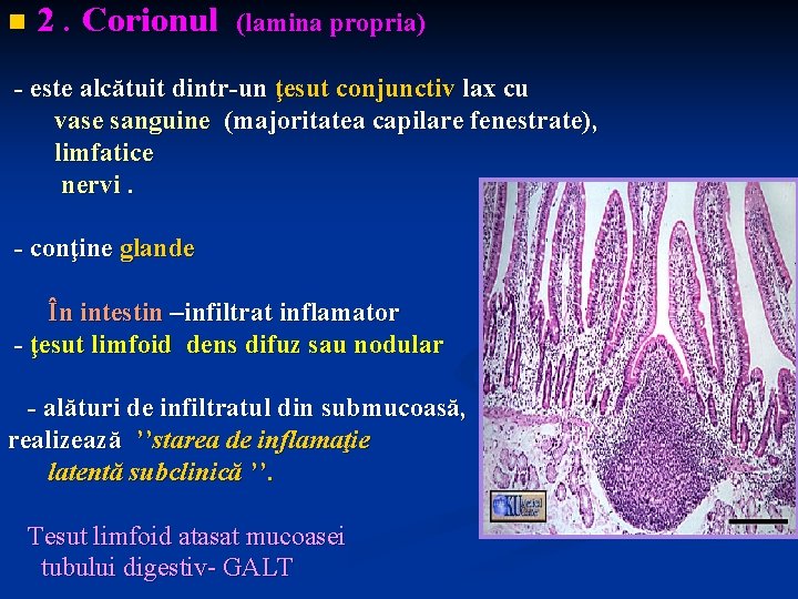 n 2. Corionul (lamina propria) - este alcătuit dintr-un ţesut conjunctiv lax cu vase