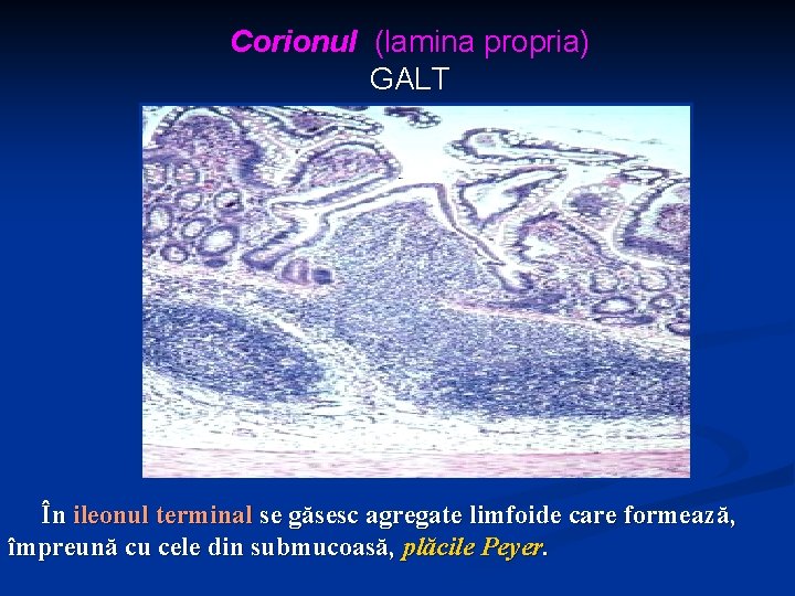 Corionul (lamina propria) GALT În ileonul terminal se găsesc agregate limfoide care formează, împreună