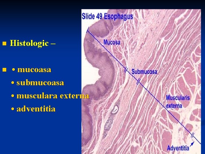 n Histologic – n • mucoasa • submucoasa • musculara externa • adventitia 