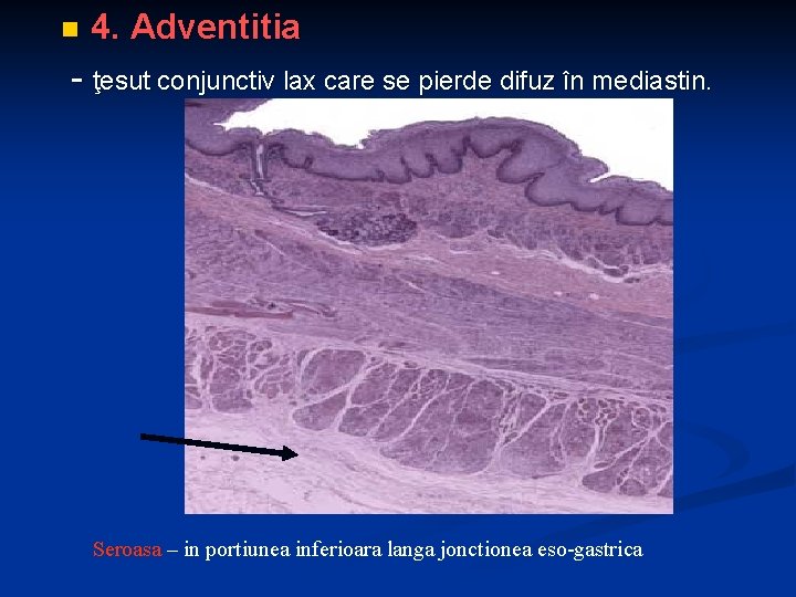 n 4. Adventitia - ţesut conjunctiv lax care se pierde difuz în mediastin. Seroasa