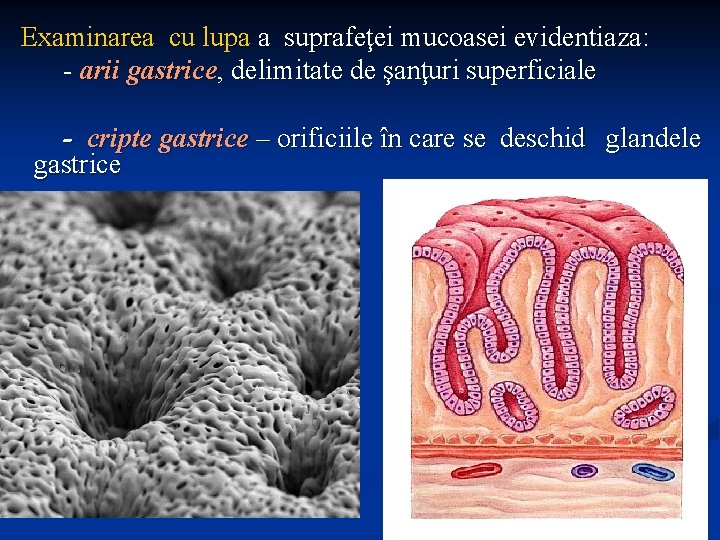 Examinarea cu lupa a suprafeţei mucoasei evidentiaza: - arii gastrice, delimitate de şanţuri superficiale