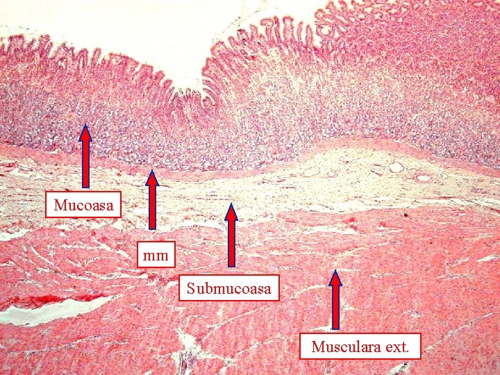 Mucoasa mm Submucoasa Musculara ext. 