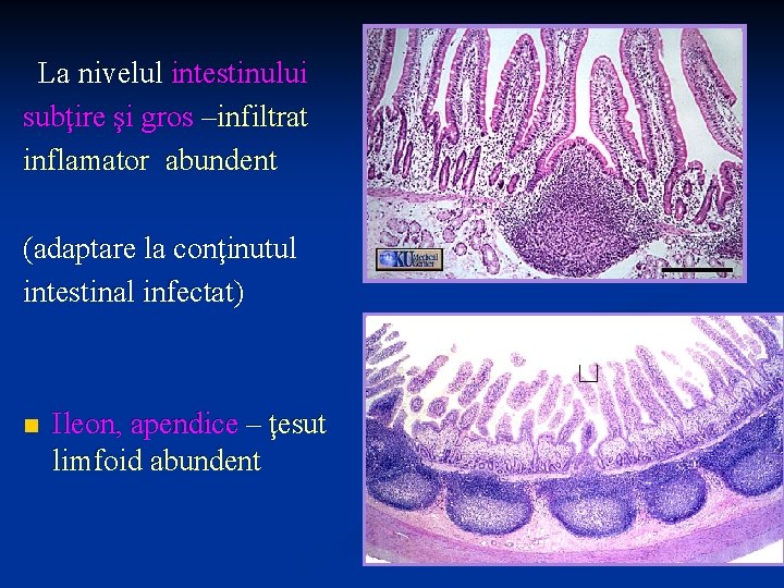 La nivelul intestinului subţire şi gros –infiltrat inflamator abundent (adaptare la conţinutul intestinal infectat)