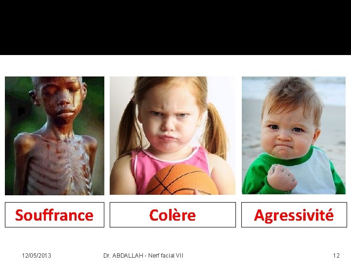 Souffrance 12/05/2013 Colère Dr. ABDALLAH - Nerf facial VII Agressivité 12 