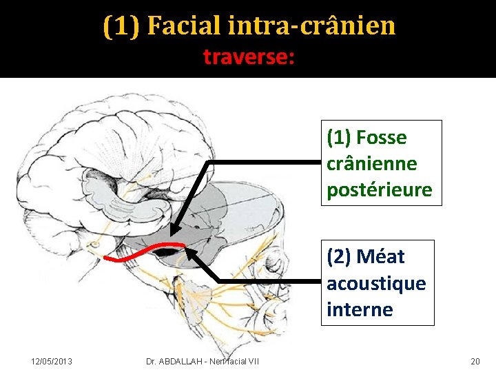 (1) Facial intra-crânien traverse: (1) Fosse crânienne postérieure (2) Méat acoustique interne 12/05/2013 Dr.