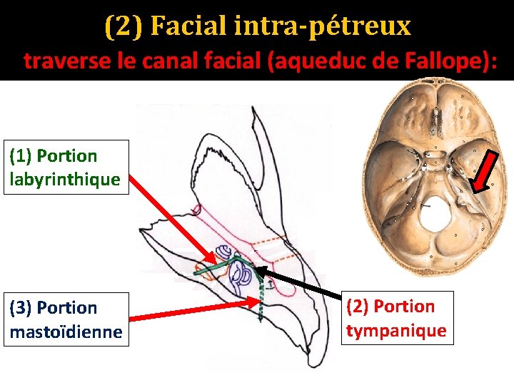 (2) Facial intra-pétreux traverse le canal facial (aqueduc de Fallope): (1) Portion labyrinthique (3)