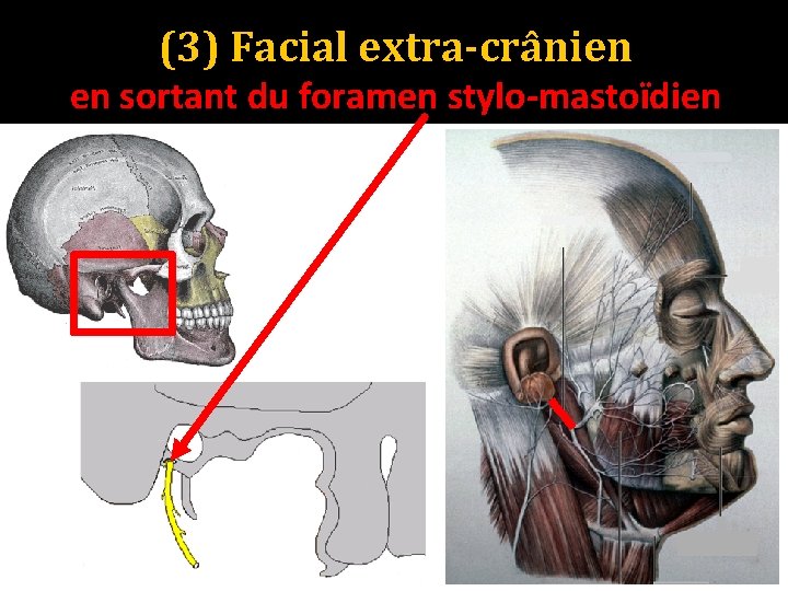 (3) Facial extra-crânien en sortant du foramen stylo-mastoïdien 