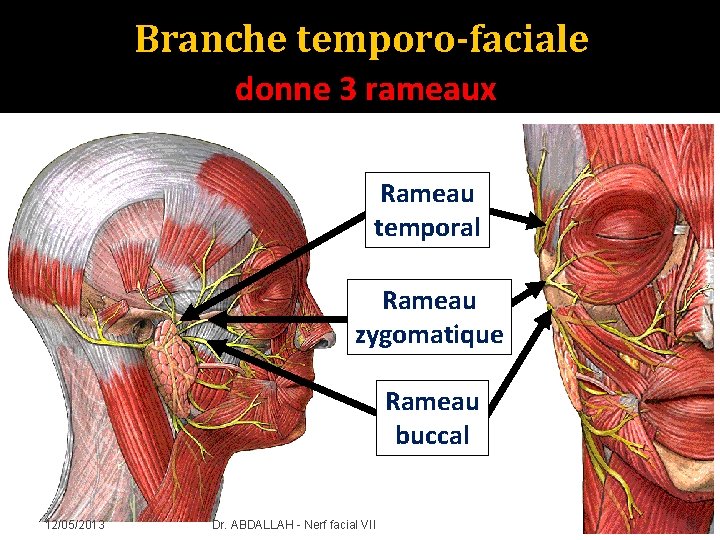 Branche temporo-faciale donne 3 rameaux Rameau temporal Rameau zygomatique Rameau buccal 12/05/2013 Dr. ABDALLAH