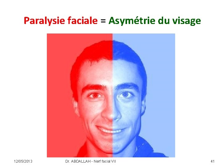 Paralysie faciale = Asymétrie du visage 12/05/2013 Dr. ABDALLAH - Nerf facial VII 41