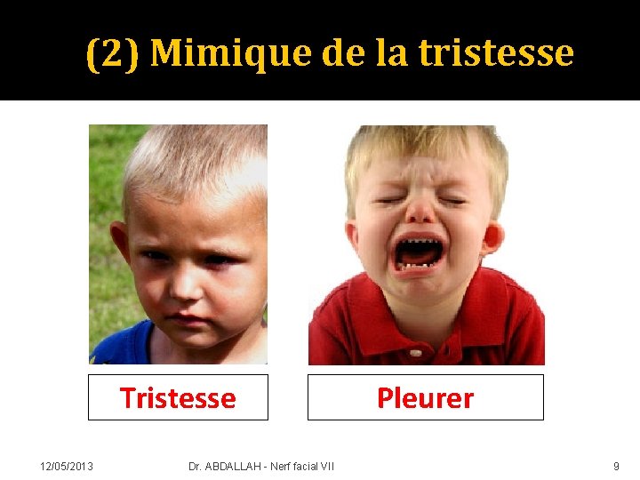 (2) Mimique de la tristesse Tristesse 12/05/2013 Dr. ABDALLAH - Nerf facial VII Pleurer