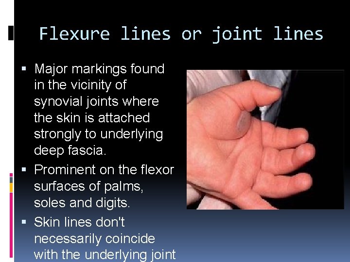 Flexure lines or joint lines Major markings found in the vicinity of synovial joints