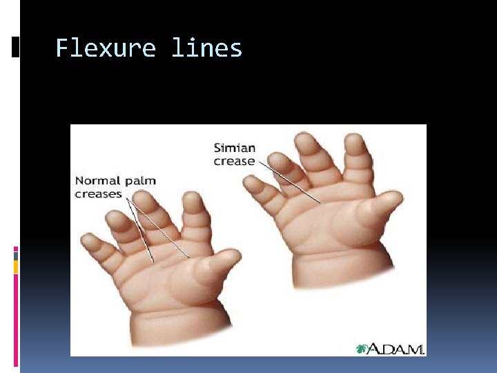 Flexure lines Flexure lines