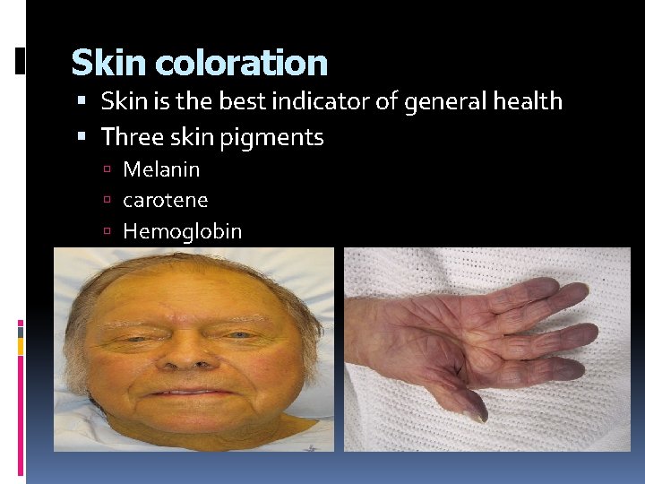 Skin coloration Skin is the best indicator of general health Three skin pigments Melanin