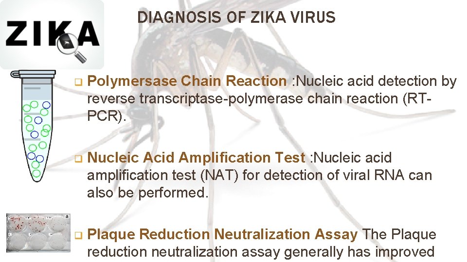 DIAGNOSIS OF ZIKA VIRUS q Polymersase Chain Reaction : Nucleic acid detection by reverse