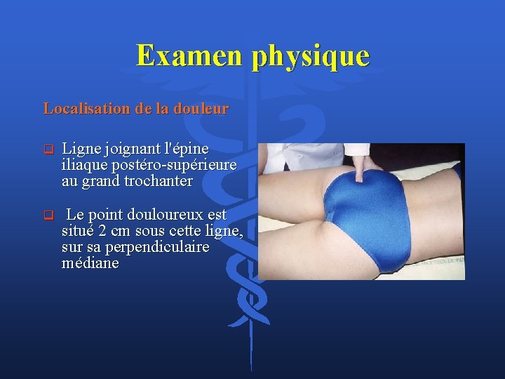 Examen physique Localisation de la douleur q Ligne joignant l'épine iliaque postéro supérieure au