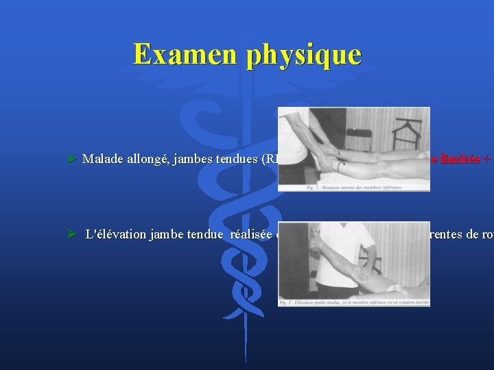 Examen physique Ø Malade allongé, jambes tendues (RI passive des MI): amplitude limitée +