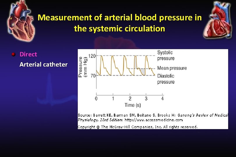 Measurement of arterial blood pressure in the systemic circulation Direct Arterial catheter 