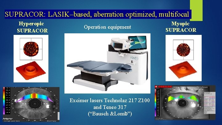 SUPRACOR: LASIK–based, aberration optimized, multifocal Myopic Hyperopic Operation equipment SUPRACOR Excimer lasers Technolaz 217