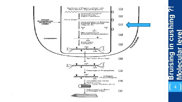 4 Bruising in cushing ? ! Molecular level 