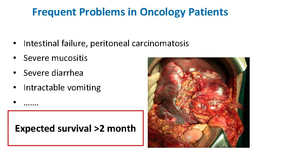 Frequent Problems in Oncology Patients • Intestinal failure, peritoneal carcinomatosis • Severe mucositis •