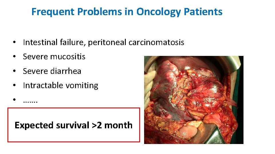 Frequent Problems in Oncology Patients • Intestinal failure, peritoneal carcinomatosis • Severe mucositis • Frequent Problems in Oncology Patients • Intestinal failure, peritoneal carcinomatosis • Severe mucositis •