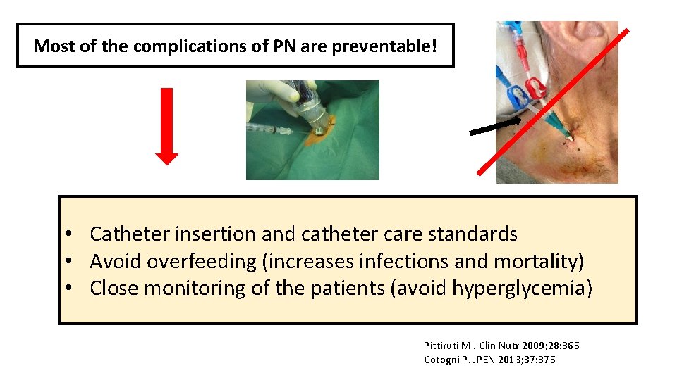 Most of the complications of PN are preventable! • Catheter insertion and catheter care