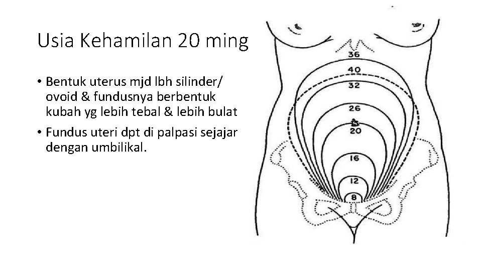 Usia Kehamilan 20 minggu • Bentuk uterus mjd lbh silinder/ ovoid & fundusnya berbentuk