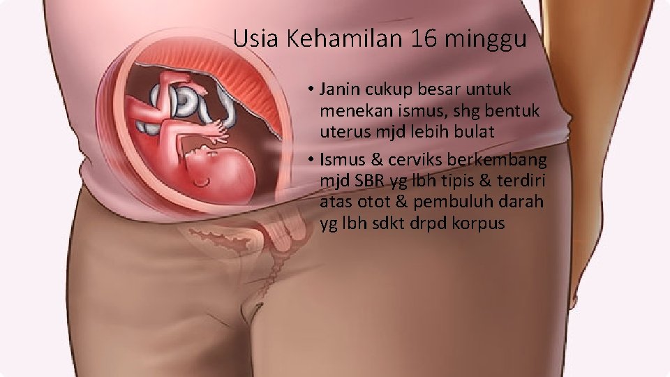 Usia Kehamilan 16 minggu • Janin cukup besar untuk menekan ismus, shg bentuk uterus