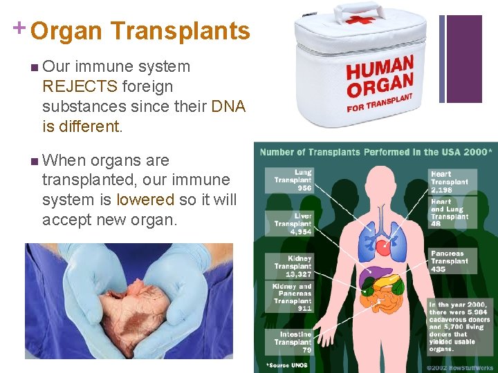 + Organ Transplants n Our immune system REJECTS foreign substances since their DNA is