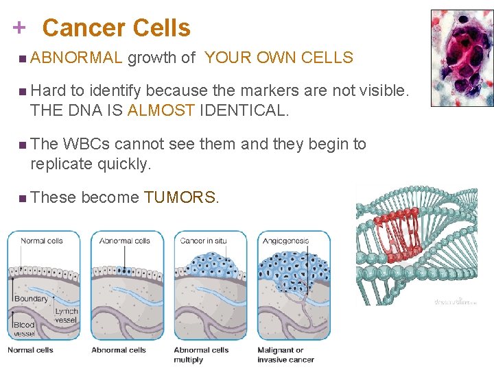 + Cancer Cells n ABNORMAL growth of YOUR OWN CELLS n Hard to identify