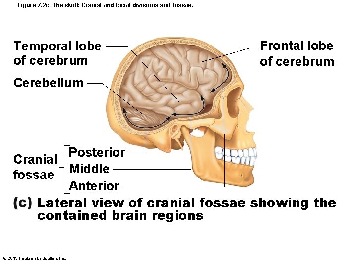 Figure 7. 2 c The skull: Cranial and facial divisions and fossae. Temporal lobe