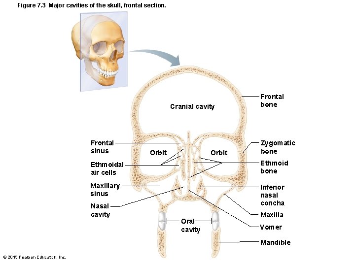 Figure 7. 3 Major cavities of the skull, frontal section. Cranial cavity Frontal sinus